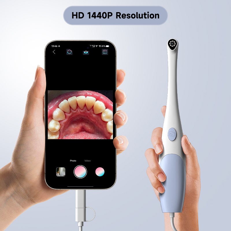 Oral Endoskop Kamera 1440P Fot - Quality Photography Lighting incelemesi ve fiyatı