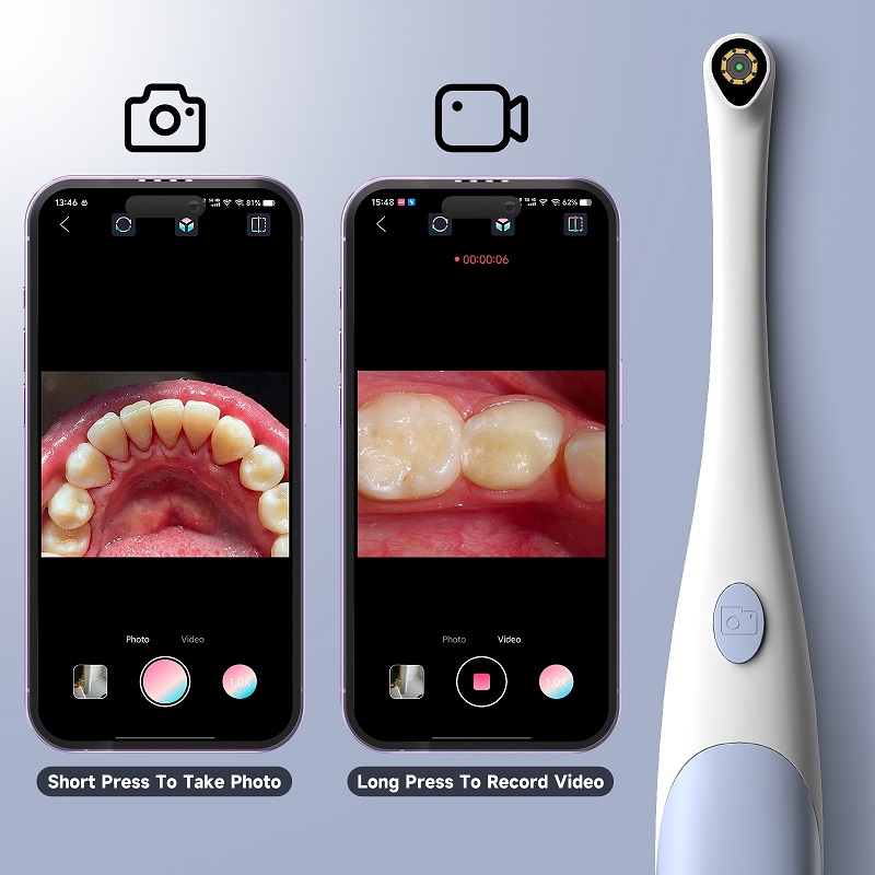 Oral Endoskop Kamera 1440P Fot - Quality Photography Lighting incelemesi ve fiyatı